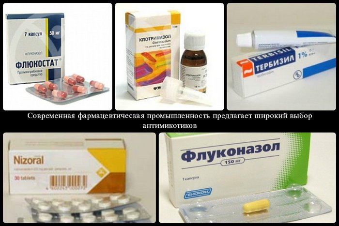 kandidoznyj-stomatit-antimikoticheskie-preparaty-dlya-lecheniya
