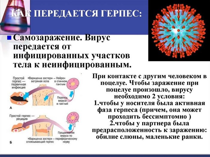 gerpes-i-koronavirus-svyaz-est-ili-net-kak-mozhno-zarazitsya-gerpesom