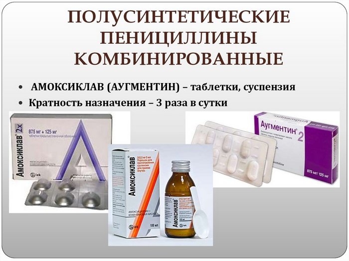 limfadenit-lechenie-antibiotikami-kakimi-u-vzroslyh-amoksiklav